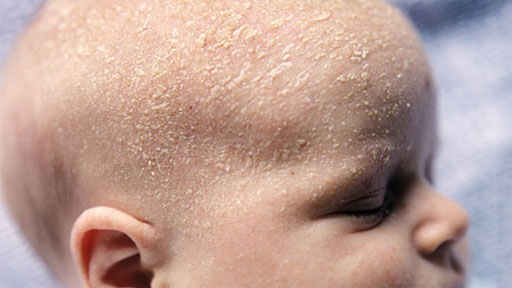 راهنمای مراقبت از پوست کودک